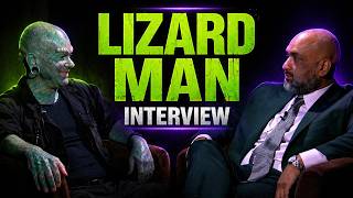 He's a man and a lizard, the best of both worlds