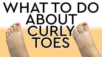 How To Deal with Curled Toes