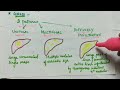 Hepatocellular Carcinoma (HCC) | Pathology | Handwritten notes