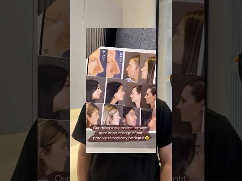 Video thumbnail: Plastic surgery IS NOT about imitation 🙅‍♂️ · Albert Plastic Surgery New York