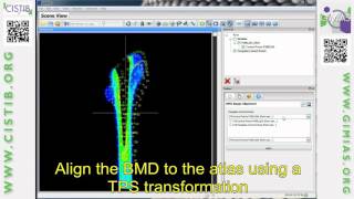Bone Mineral Density (BMD) Image Alignment