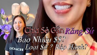 Taylor Chia Sẻ Những Điều Nên Biết Khi Gắn Răng Sứ, Nên Chọn Loại Sứ Nào, Giá Bao Nhiêu, Bảo Hành???