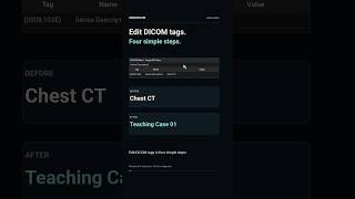 Information How to Edit DICOM Tags | Metadata in 4 Steps Update