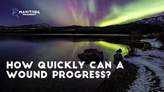 How Quickly Can A Wound Progress?