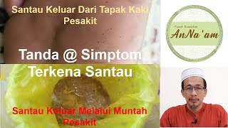 Santau - Tanda @ Simptom Orang Terkena Santau