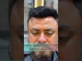 Australian Mirage Hair Patch#hairwig #hairpatch#nonsurgicalhairreplacement #kolkata#hairlosssolution