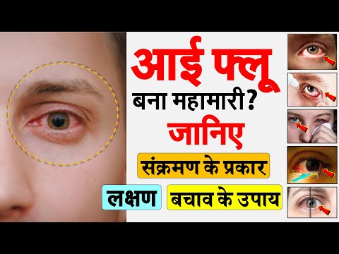 वीडियो: मैं कर्नेलबेस डीएलएल को कैसे ठीक करूं?