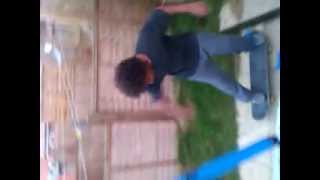Epic fail trying to do Ollie