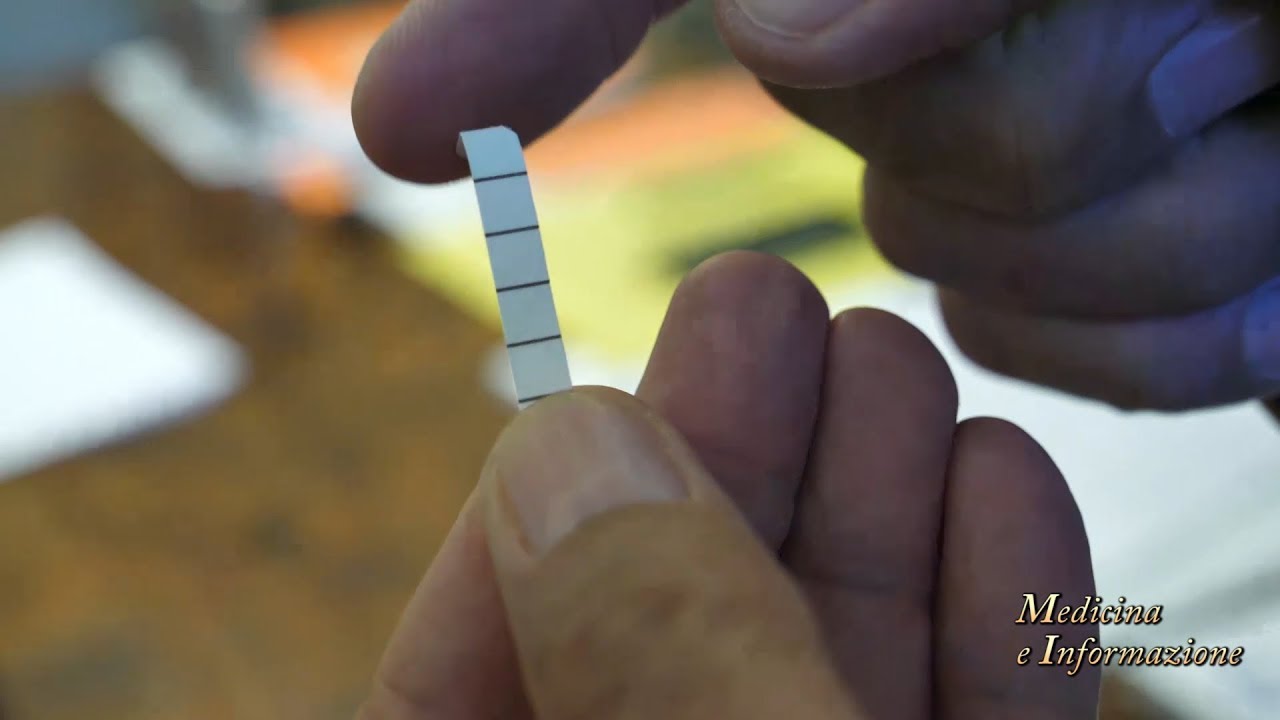 Sindrome dell'Occhio Secco: i colliri specifici per contrastarla