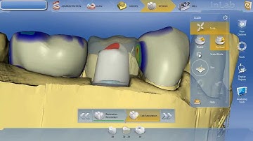 inLAB 4.0  Fixing poor abutment proposals 1