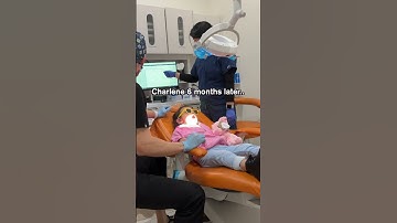 Highly observant child remembers instructions TOO well 😂 [Pediatric Dentist]