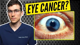 سرطان چشم؟ کک و مک چشم در مقابل ملانوما چشم