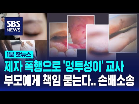 [1분핫뉴스] 6학년에 맞아 멍투성이 된 교사, 학부모에 손배 소송 / SBS