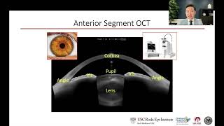 Using AI in Glaucoma Imaging (prof. Benjamin Yi Xing Xu, USA)