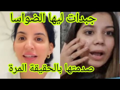 اسماء بيوتي و لوستها جبدت ليها الضواسا صدمتها بالحقيقة المرة