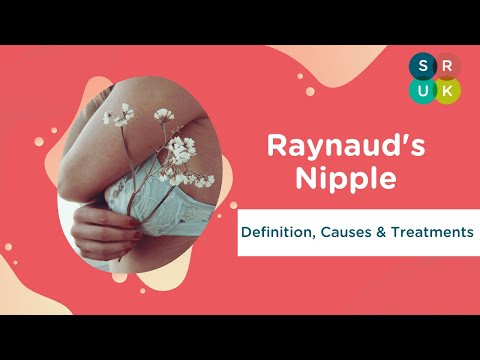 Raynaud's Nipple - with Dr Elizabeth Price