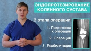 Эндопротезирование коленного сустава. Подготовка, проведение эндопротезирования, реабилитация