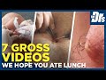 7 of the Grossest Things The Doctors Have Ever Seen
