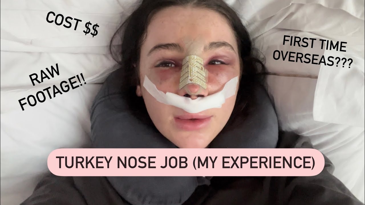 turkey nose job vlog ???? YouTube