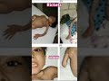 #neetpg #medicosstuff #trending #youtubeshorts #viral #doctor #neet #hospital #funny#cricket#virat