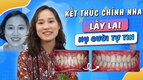 Niềng Răng - Bí Quyết Lấy Lại Nụ Cười Tự Tin | Nam Bùi Vinalign
