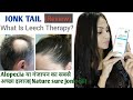 Jonk Tail Review|What Is Leech Therapy For Alopecia /Prevents Hair Loss, Hair Fall &amp; Dandruff