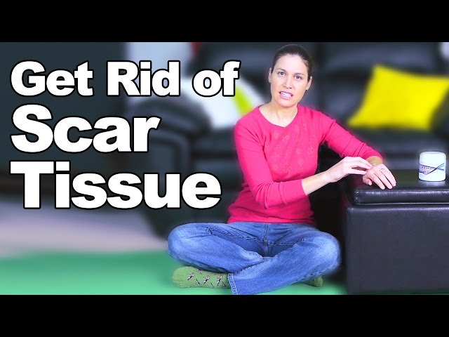 Get Rid of Scar Tissue - Ask Doctor Jo