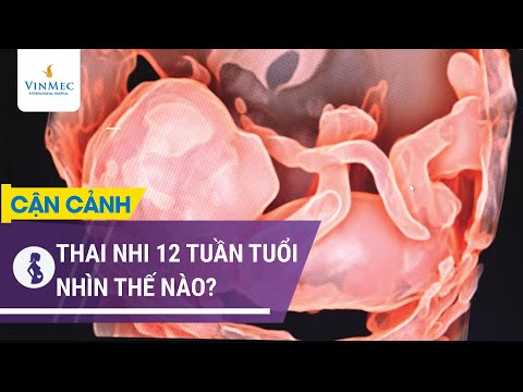 Video: 12 Tuần Của Thai Kỳ: Cảm Giác, Sự Phát Triển Của Thai Nhi, Siêu âm