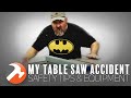 My Table Saw Accident: Safety Tips & Equipment My Table Saw Accident: Safety Tips & Equipment