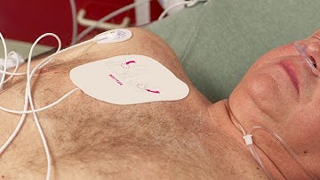 Synchronized Cardioversion with the HeartStart Intrepid monitor/defibrillator