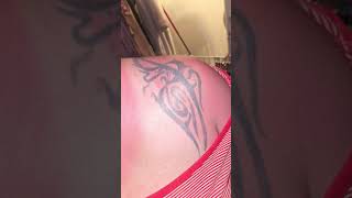 our sun is not the same #fakesun.#burn #ouch