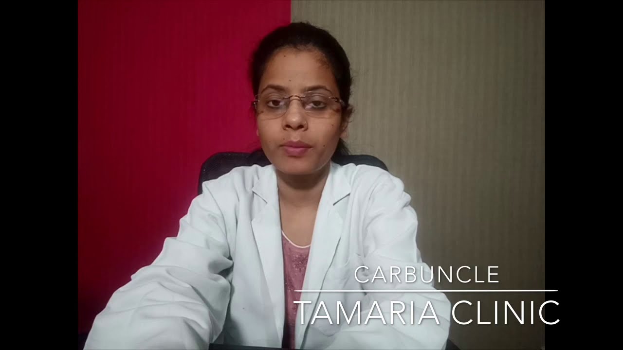 Homeopathic treatment of carbuncle!!