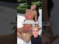 Kylie Jenner reveals exactly what plastic surgery she has done! #kyliejenner