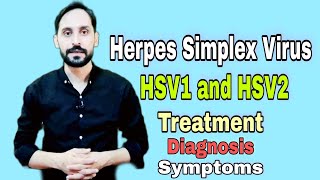 Herpes Simplex Virus HSV | Types | Diagnosis | Symptoms | Treatment and Prevention