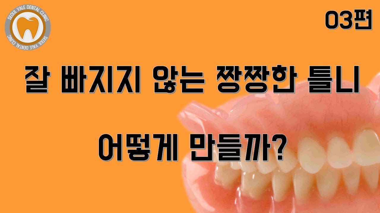짱짱틀니 3탄 리베이싱, 리라이닝/Denture rebasing relining