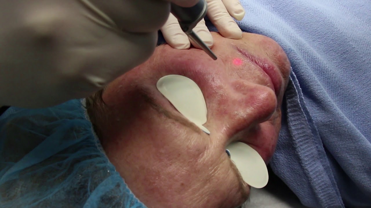 Banner for Laser Resurfacing Treatments with Dr. Groff