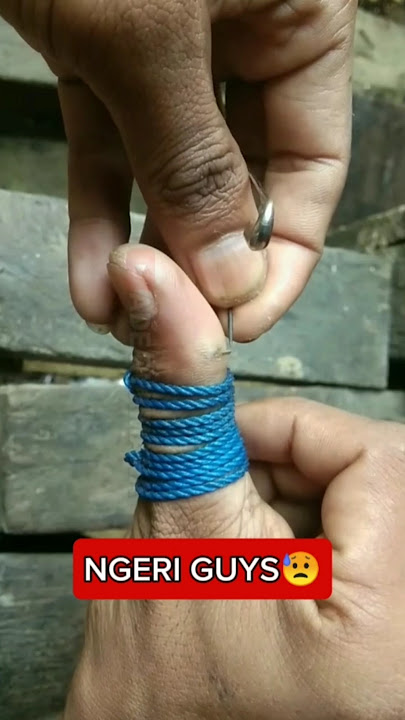 PULLING OUT A TORN IN THE FLESH, FINGER TIED IN A ROPE part1 #fyp #shorts #feedshorts #reels #tre...