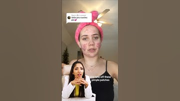 SUBSCRIBE for SKINCARE- Dr V #cysticacne #acne #pimples #skincareroutine