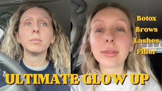Post-Divorce Glow Up | 1 week transformation | Lip Filler, Botox, Brows, Lashes, Teeth Whitening