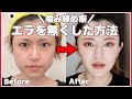 【エラ】と噛みしめ癖なくした方法！