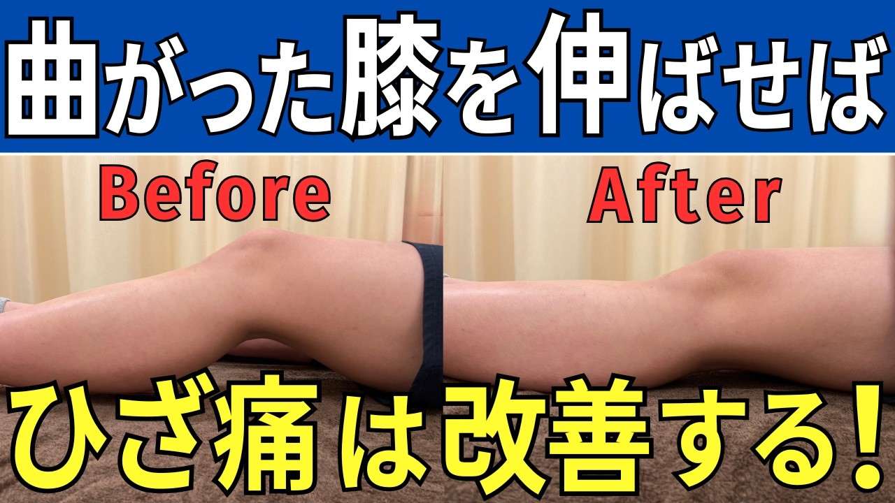 ★ DVD 「統括治療法マスタープログラム + 肩痛・膝痛撃退テクニック編」 ★ 617zfKHp8YL.jpg