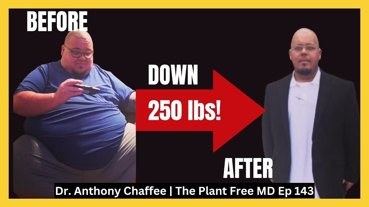He Only Ate Meat For 1 Year and This Is What Happened! Shawn White