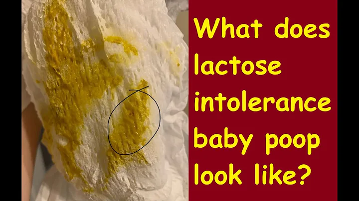 What does lactose intolerance baby poop look like? - DayDayNews