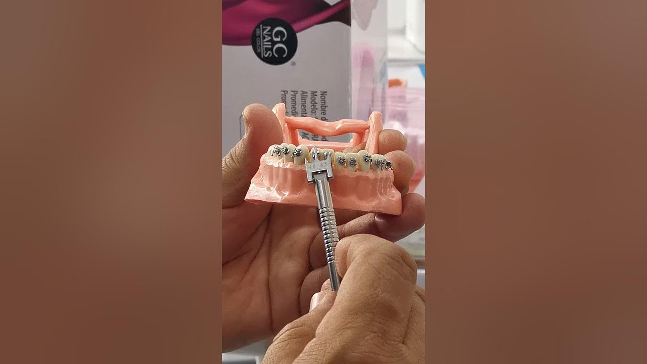 Como poner brackets para Drs YouTube