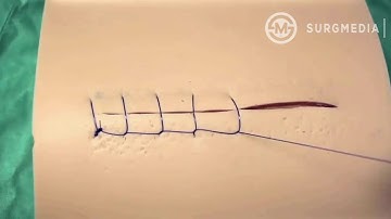 Ford Interlocking (Reverdin - Multanovski - Continuous Lock - Lock Stitch) Suture Pattern