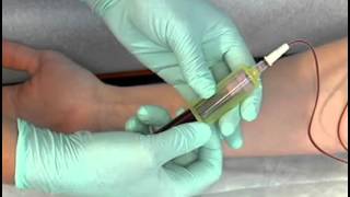 Sample Procedure - Venipuncture Butterfly Method(, 2013-10-24T18:53:44.000Z)
