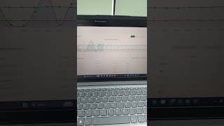 INTEGRASI IOT DAN WEB LARAVEL REST API #arduino #coding #arduinoproject #smartphone #programming