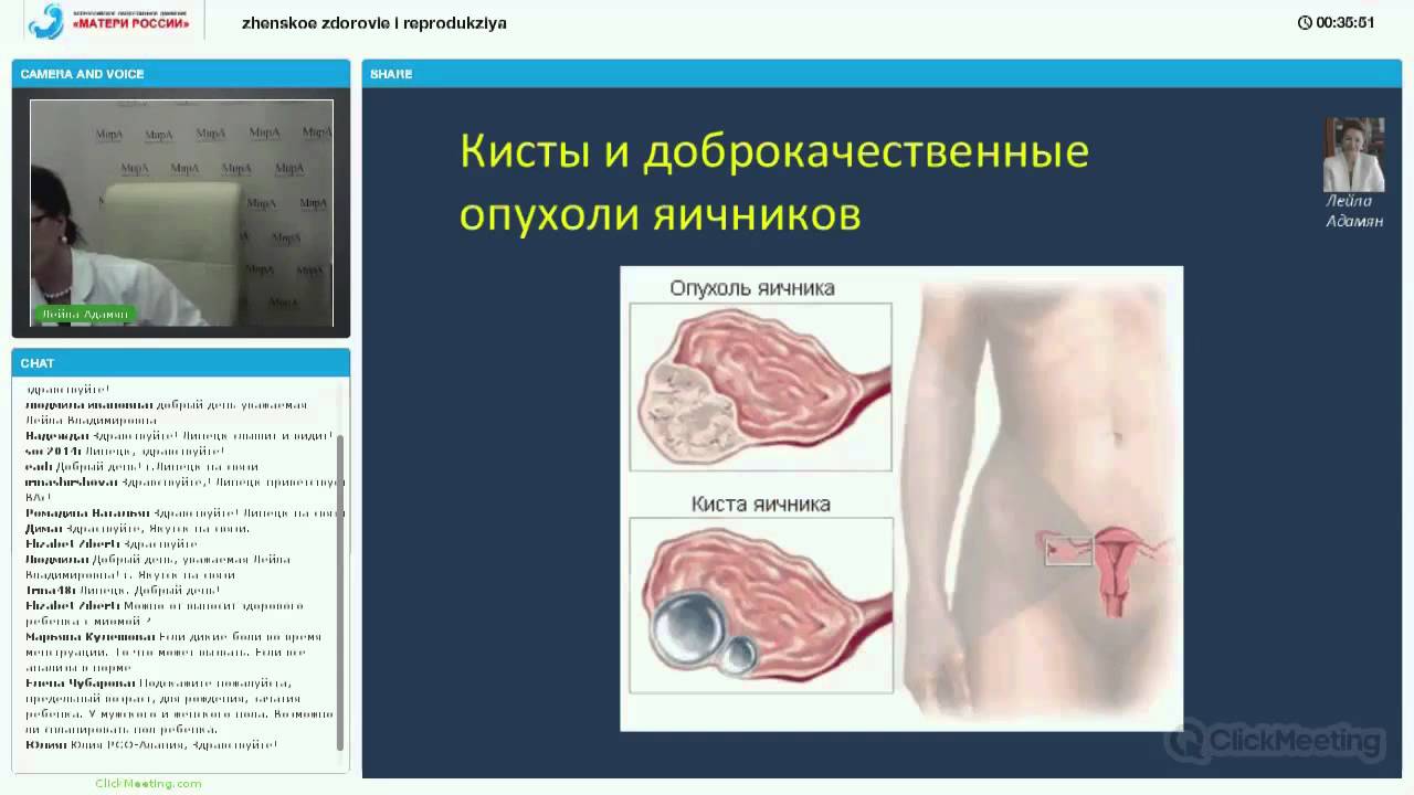 Женские болезни и их симптомы Женские болезни и их симптомы
