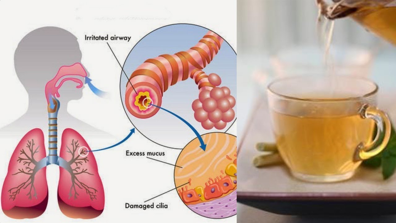 How to Get Rid of Phlegm and Mucus in Chest & Throat YouTube