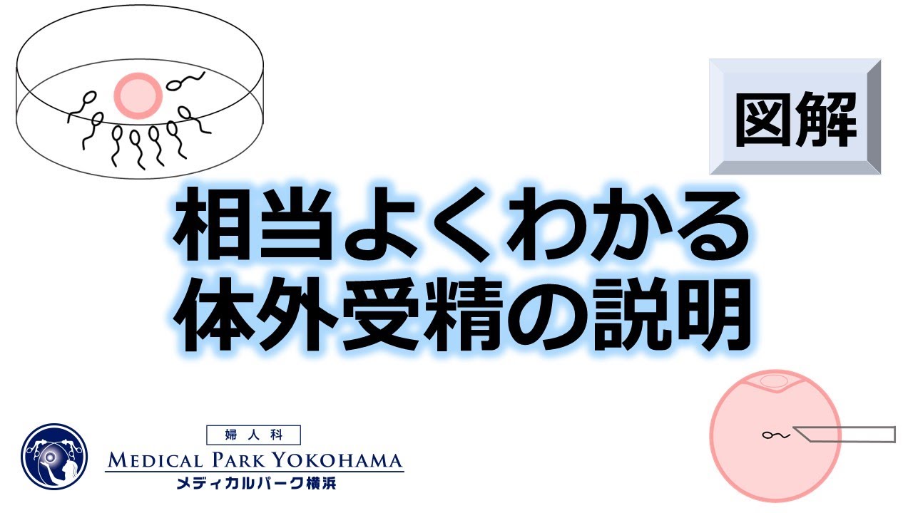体外受精編